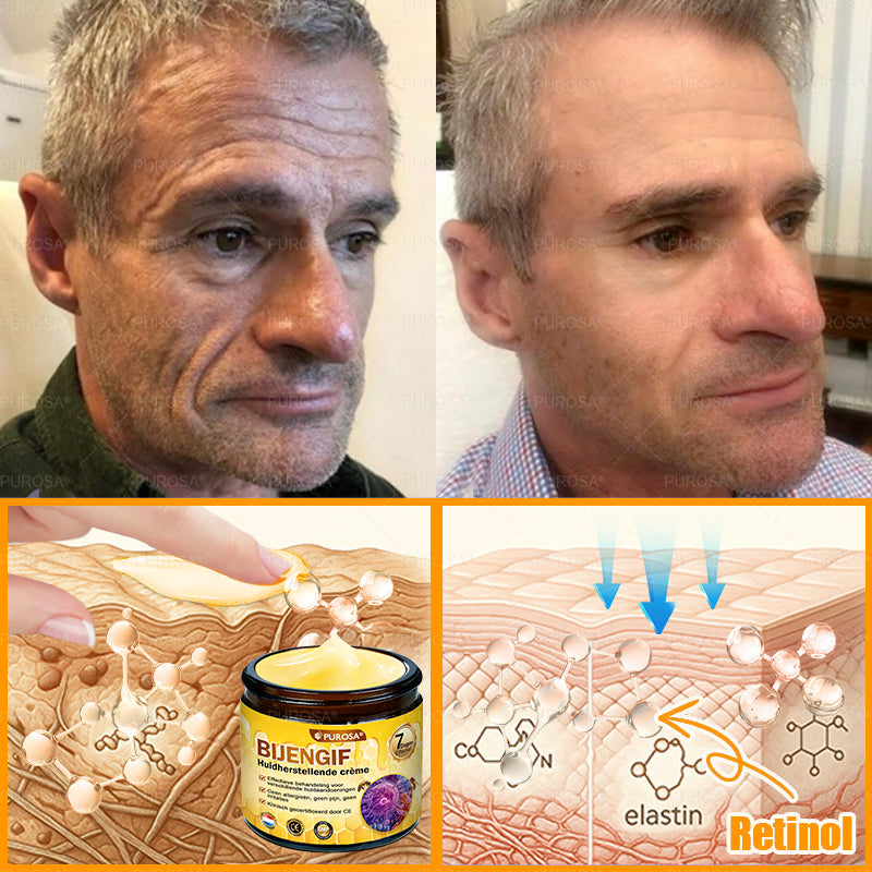 PUROSA® Bijengif Huidherstellende Crème