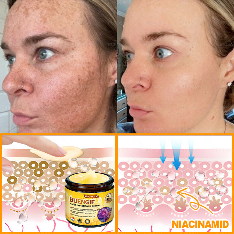 PUROSA® Bijengif Huidherstellende Crème