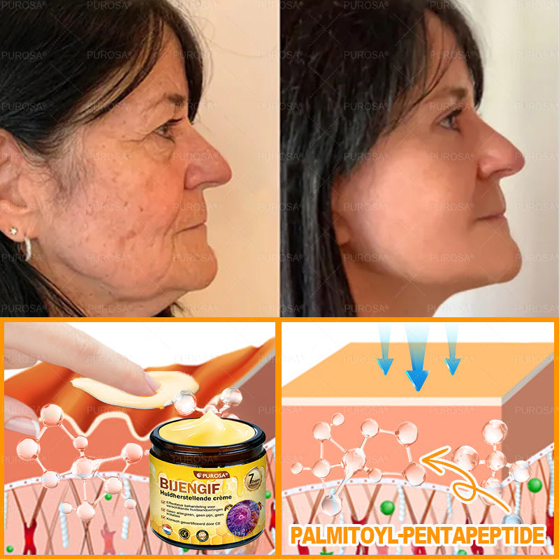 PUROSA® Bijengif Huidherstellende Crème