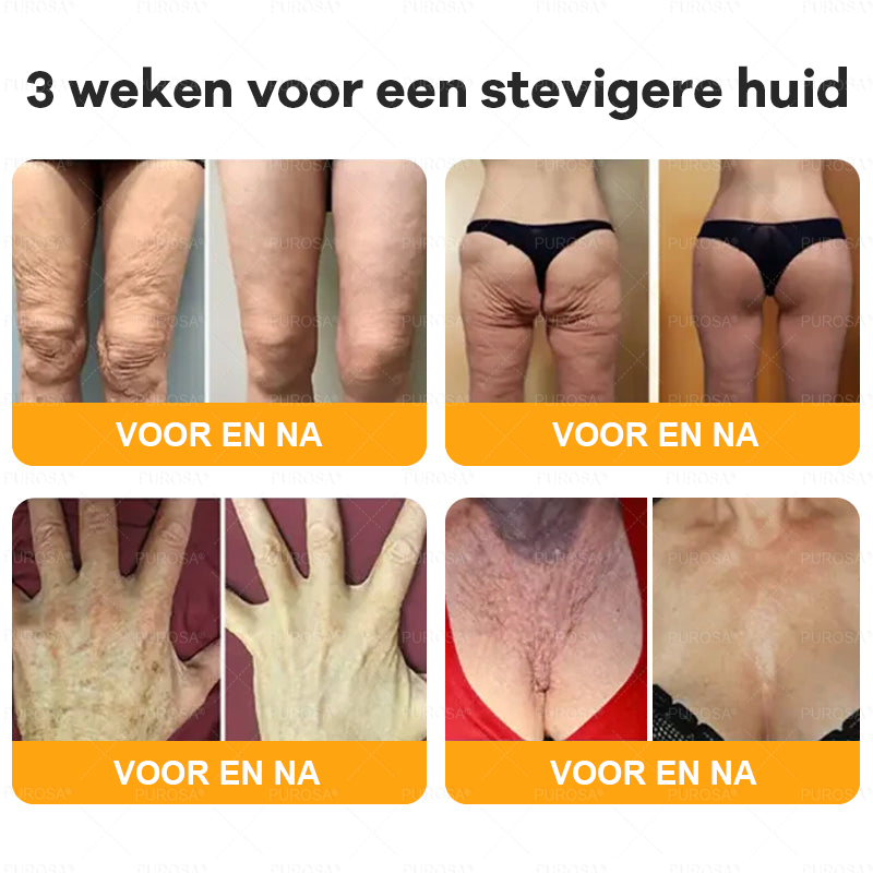 PUROSA® Bijengif Huidherstellende Crème