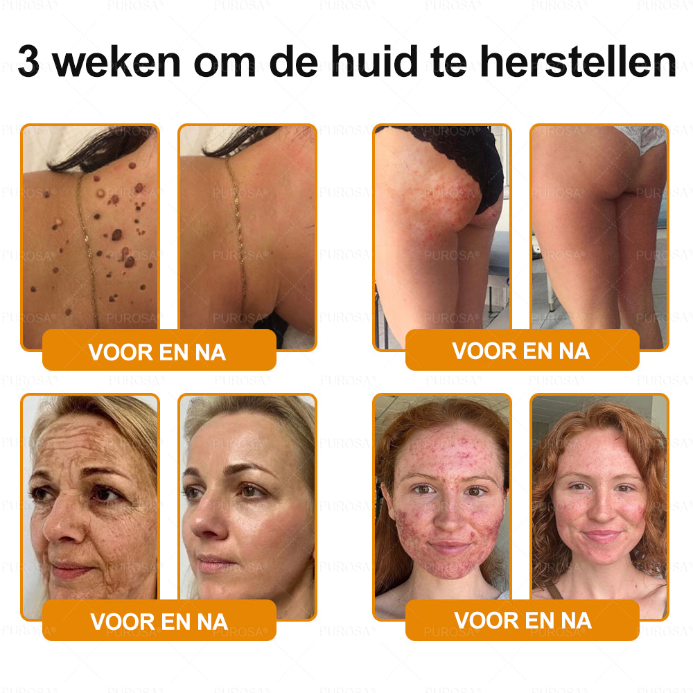 PUROSA® Bijengif Huidherstellende Crème