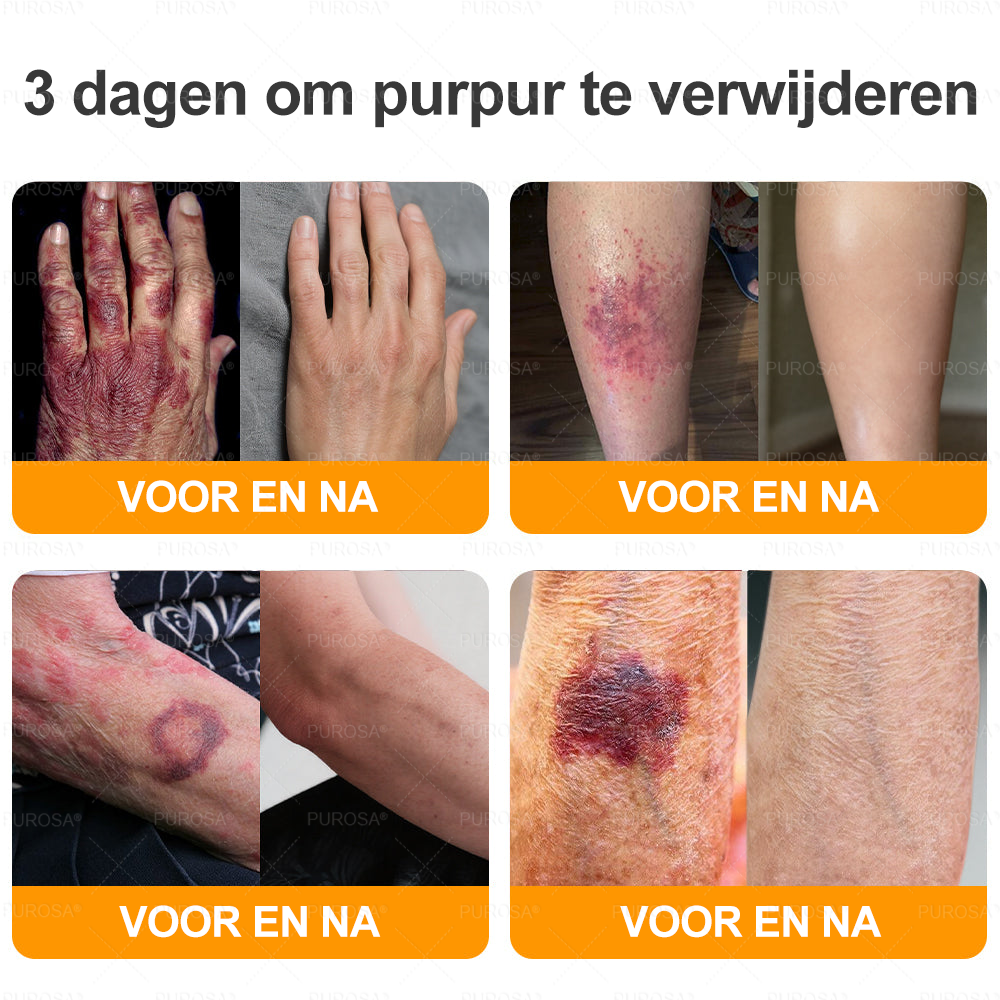 PUROSA® Bijengif Huidherstellende Crème