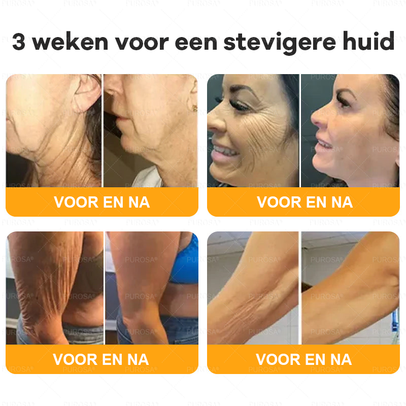 PUROSA® Bijengif Huidherstellende Crème