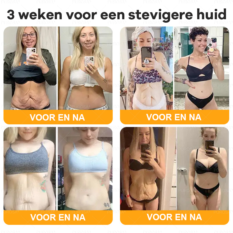 PUROSA® Bijengif Huidherstellende Crème