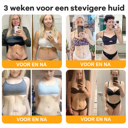 PUROSA® Bijengif Huidherstellende Crème